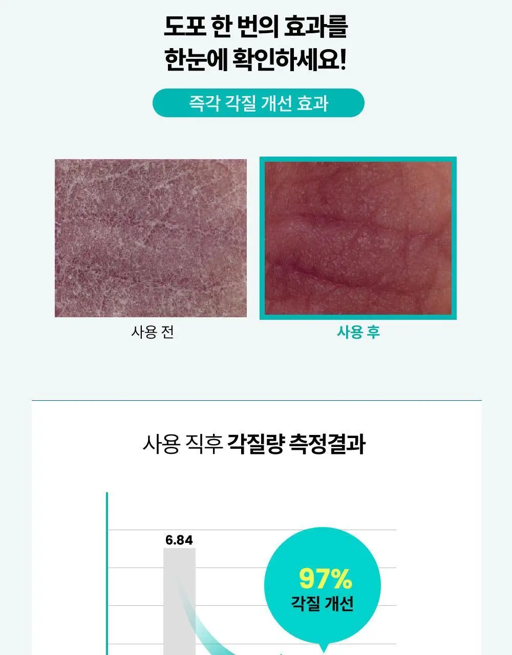 [등드름/미백기능성]더마비 AC컨트롤 바디로션 400ml 상세페이지 16